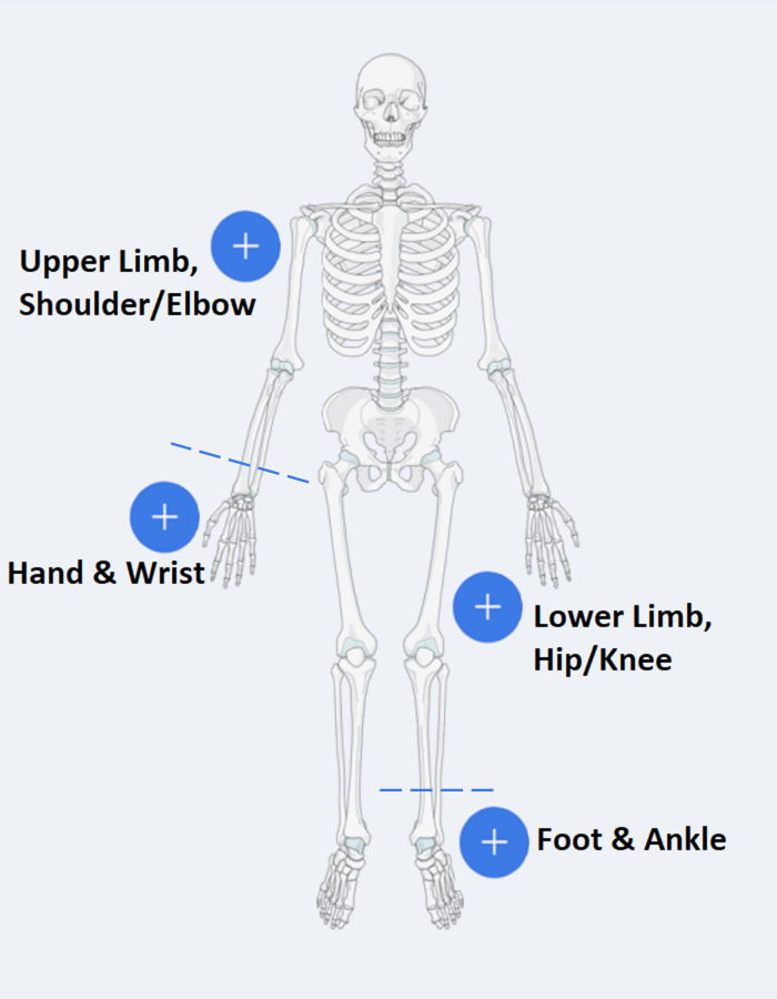 Skeleton diagram